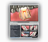 Dental Patient Education Web Player